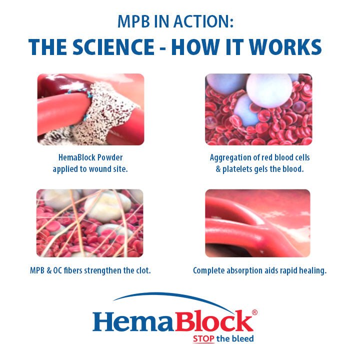 HemaBlock Hemostatic Powder, 0.5 gm Syringe Applicators, 5 pk - VB1E - 0.5 gm Syringe Applicator, 5 pk - 4